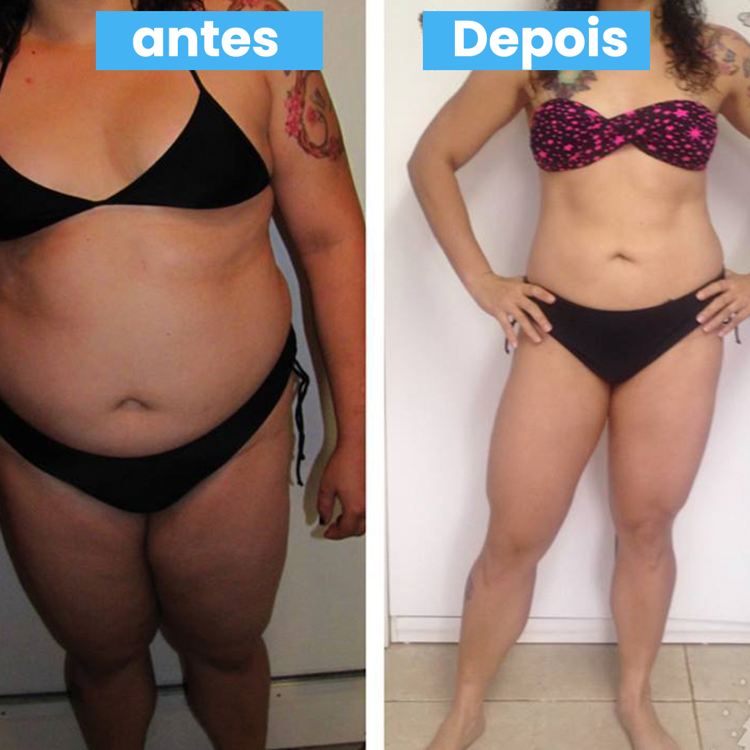 ANTES E DEPOIS 1