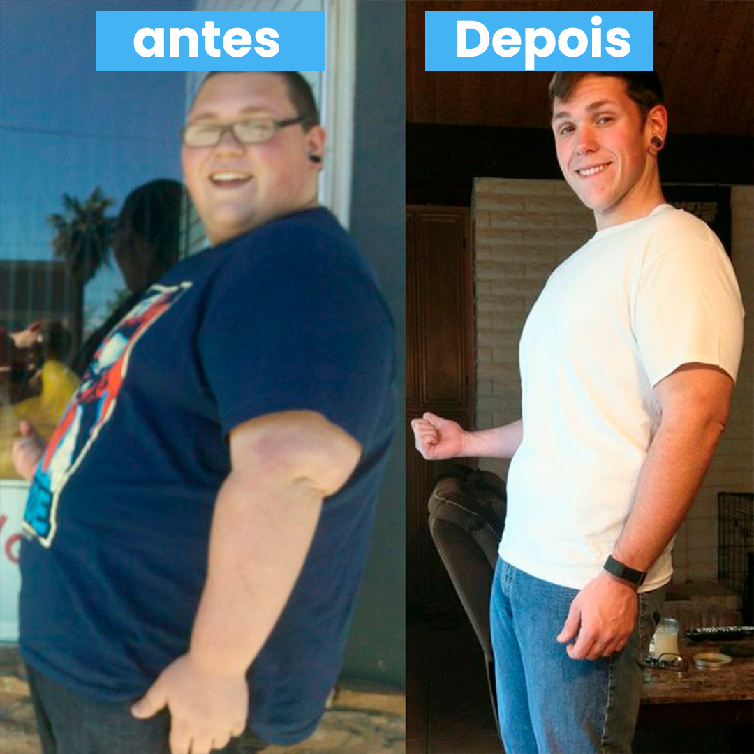 ANTES E DEPOIS 2