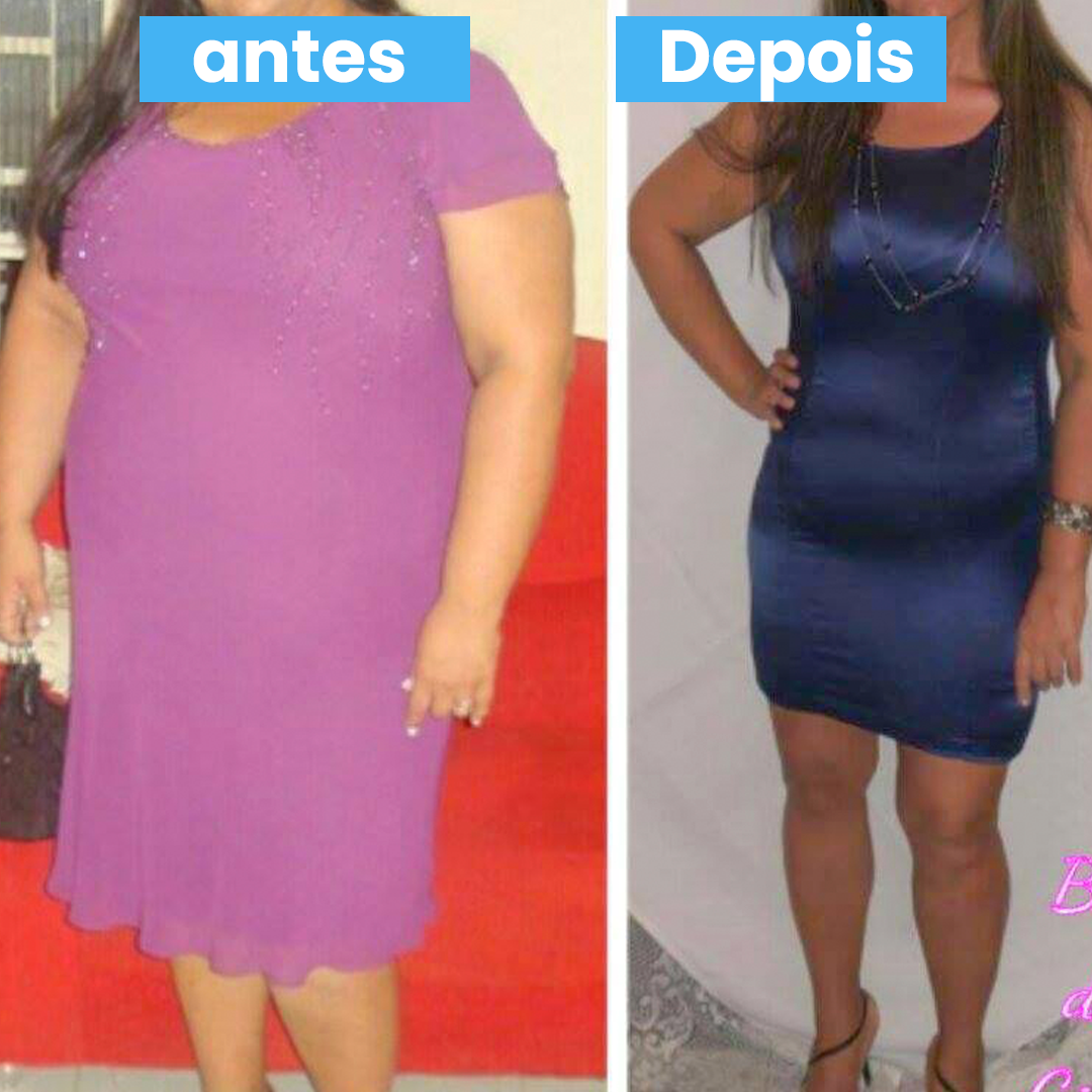 ANTES E DEPOIS 3